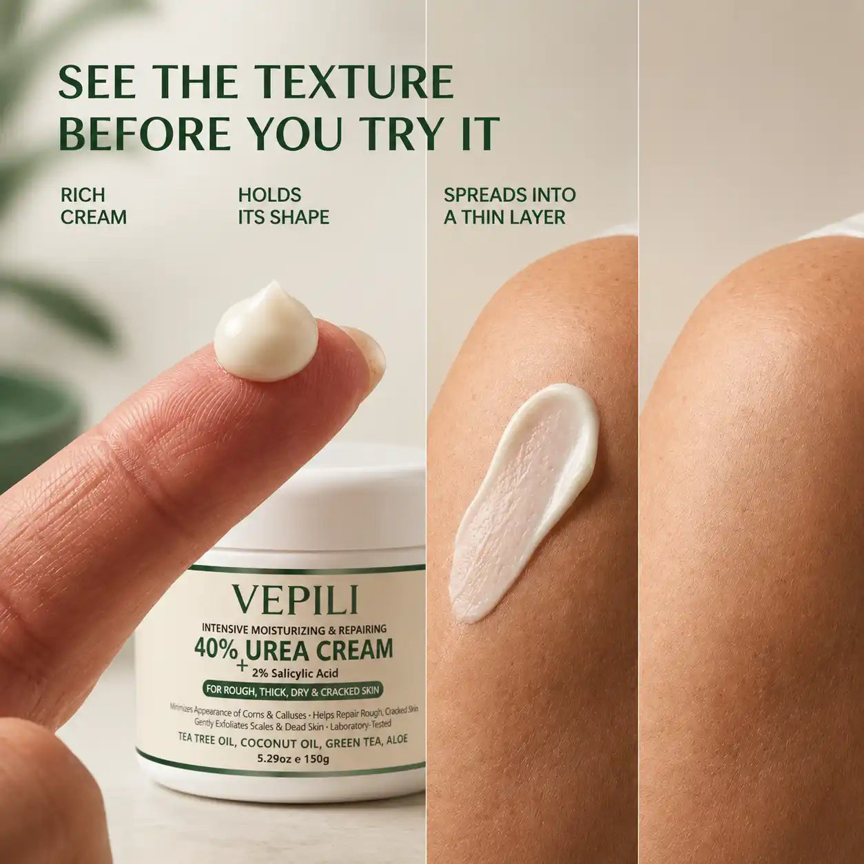 Advanced Keratolytic Cream For Rough, Raised Seborrheic Keratoses
