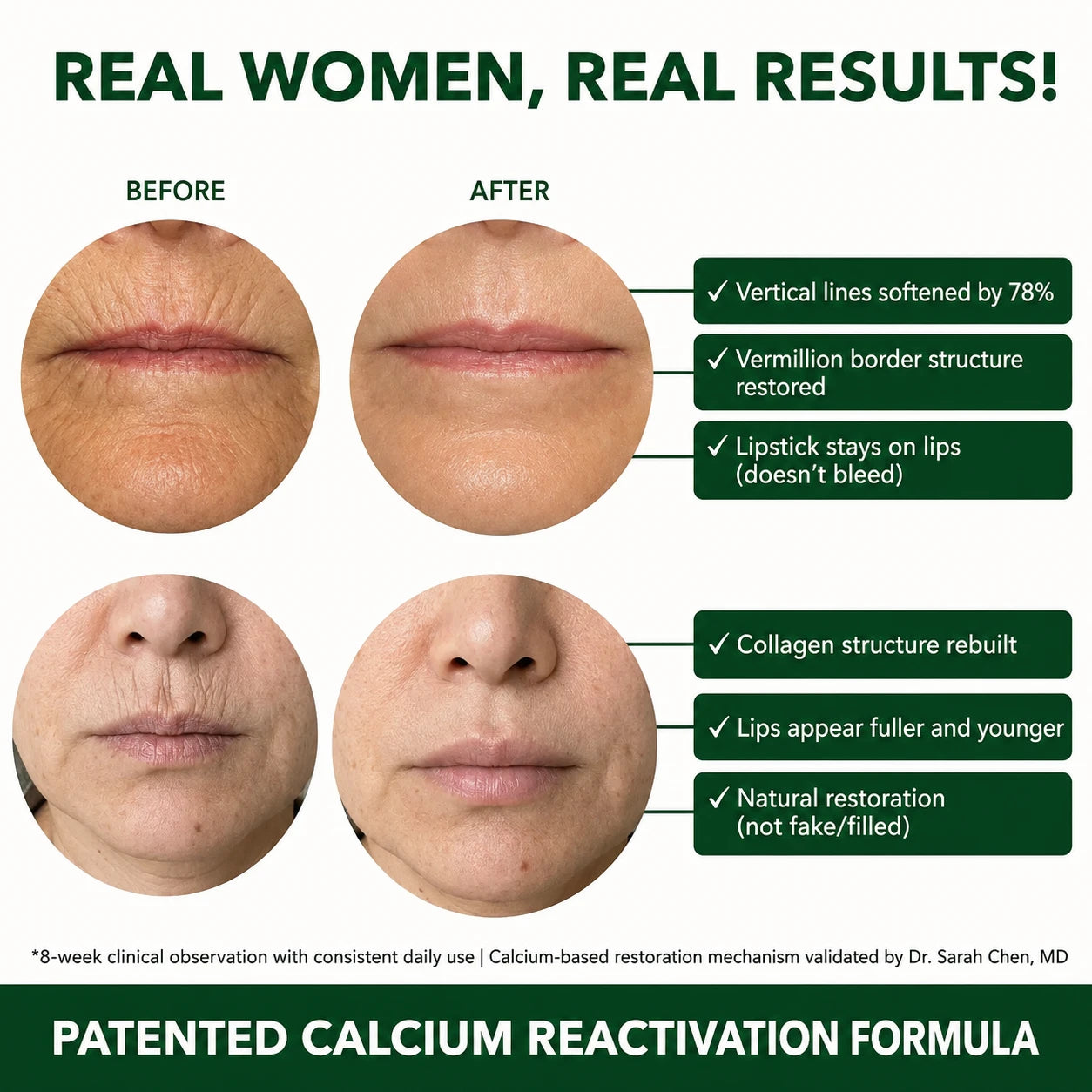The Rebuild Stick: The Korean Beauty Secret to Erasing Vertical Lip Lines
