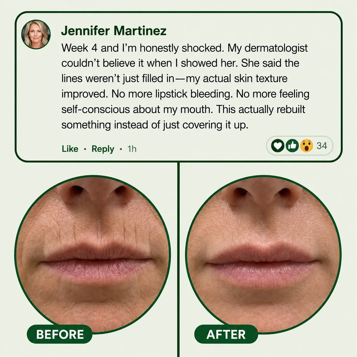 The Rebuild Stick: The Korean Beauty Secret to Erasing Vertical Lip Lines