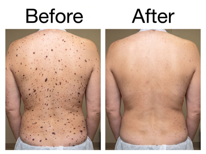 Smooth & Even Glycolic Body Stick