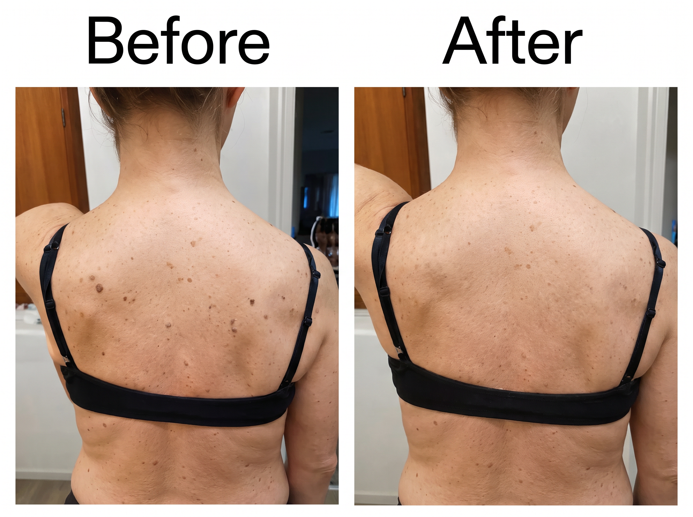 Smooth & Even Glycolic Acid Body Stick